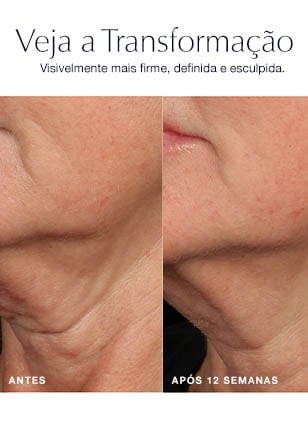 Sérum Lift e Firmeza Revitalizing Supreme