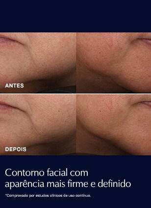 Hidratante Antirrugas Revitalizing Supreme+ Pele Seca